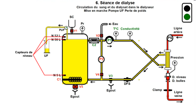 Schéma d'une cuve en circuit fermé pendant une séance de dialyse - Universités d'été de la SFNDT